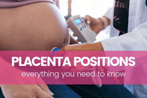 Your Guide to Placenta Positions!